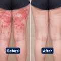 AeroCore™ Gel Cushion