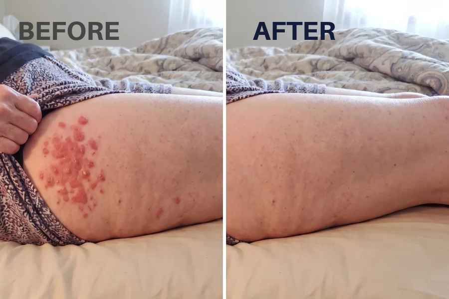 Before and after AeroCore
