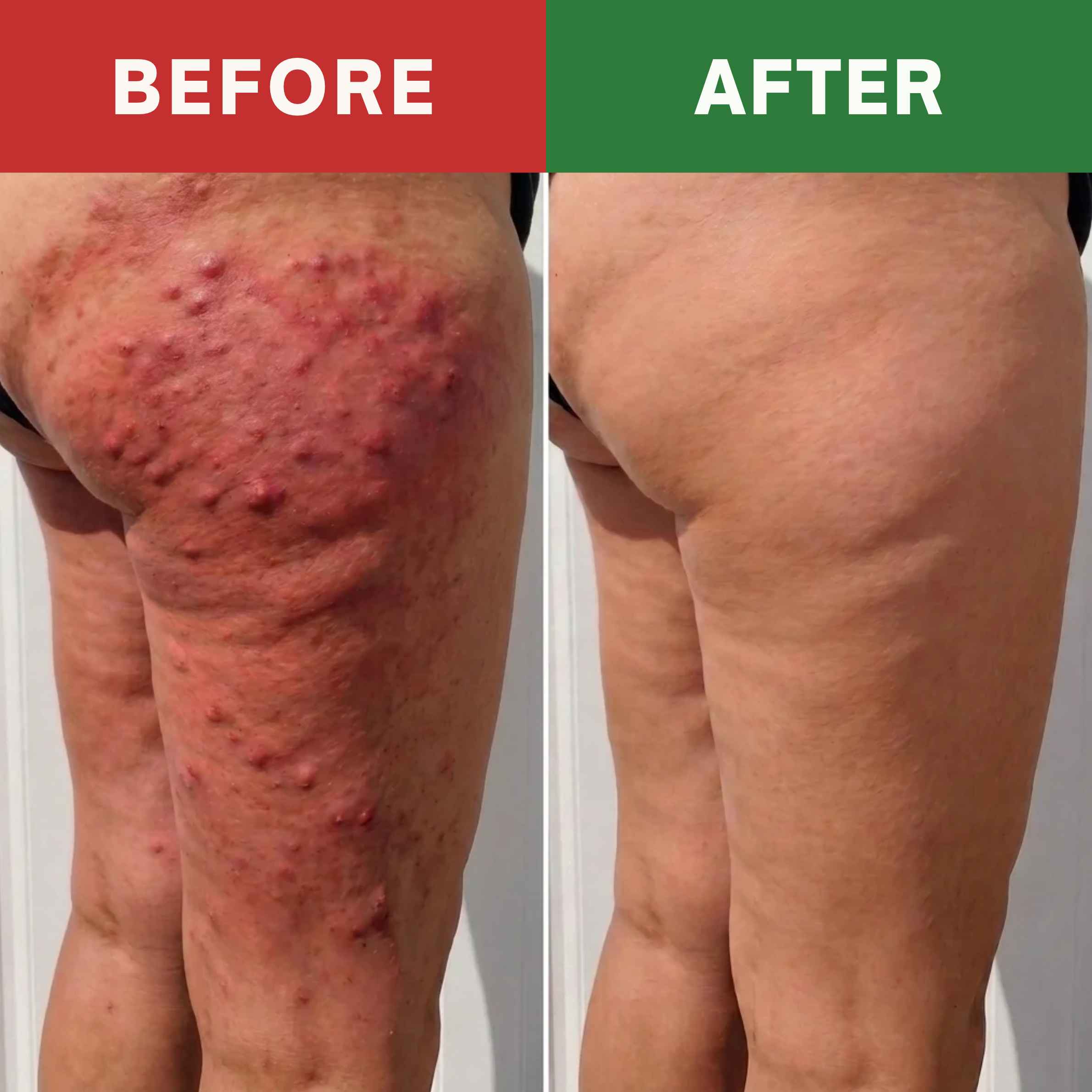 Before and after AeroCore result